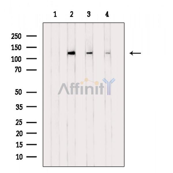 PERK Mouse monoclonal Antibody - Western blot analysis of extracts from various samples, using PERK Antibody.