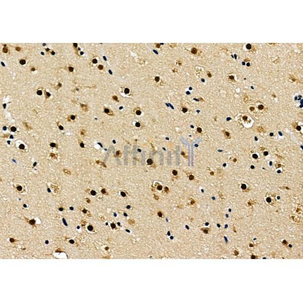 BCL9 Antibody - DF12515 at 1/100 staining Mouse heart tissue by IHC-P.