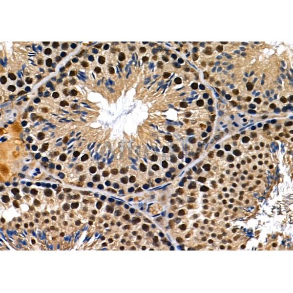 BCL9 Antibody - DF12515 at 1/100 staining Mouse lung tissue by IHC-P.