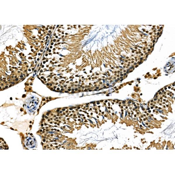 BCL9 Antibody - DF12515 at 1/100 staining Rat kidney tissue by IHC-P.