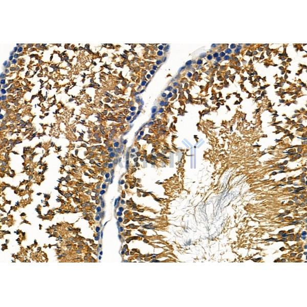 PIWL1 Antibody - DF12517 at 1/100 staining Rat kidney tissue by IHC-P.
