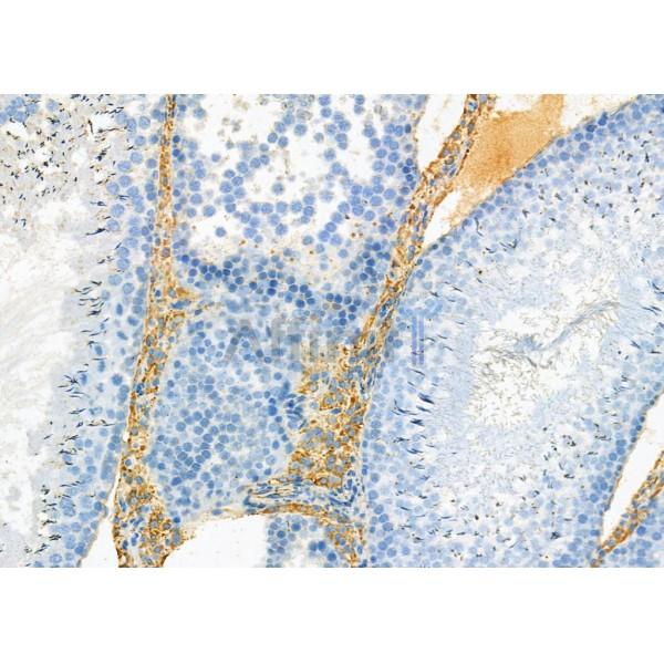DNAJB12 Antibody - DF12598 at 1/100 staining Rat kidney tissue by IHC-P.