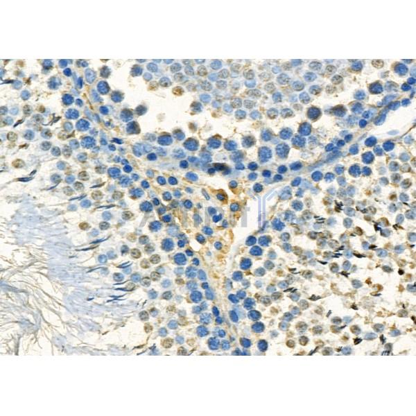 MED12 Antibody - DF12656 at 1/100 staining Rat kidney tissue by IHC-P.