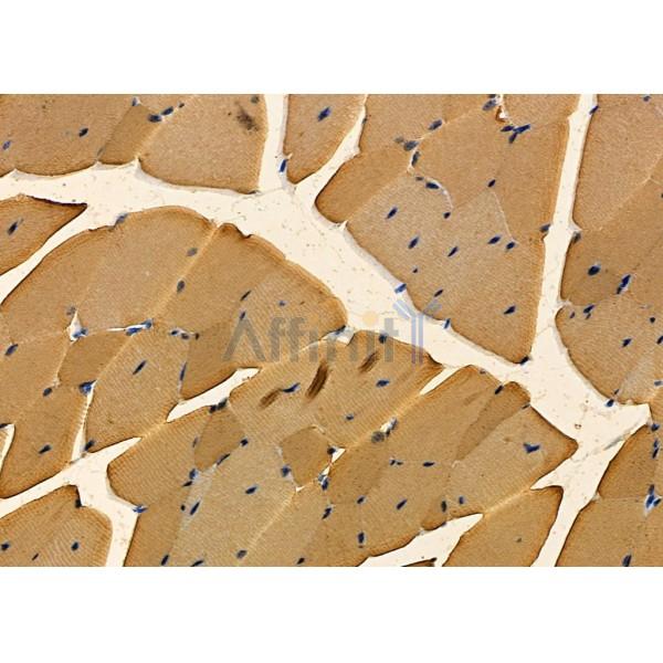 RIC8A Antibody - DF12722 at 1/100 staining Mouse kidney tissue by IHC-P.
