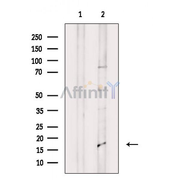 IL1F8 Antibody - Western blot analysis of extracts from HepG2 cells(serum starvation treatment), using IL1F8 Antibody.