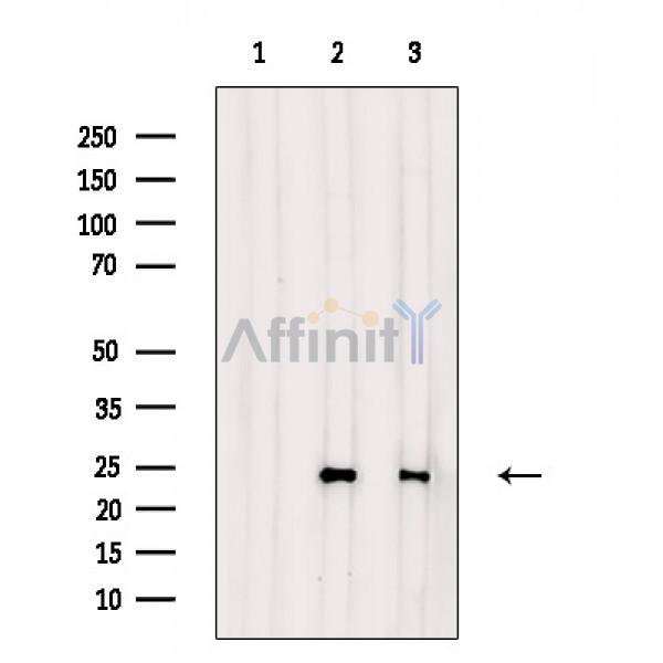 CBLN2 Antibody - Western blot analysis of extracts from various samples, using CBLN2 Antibody.