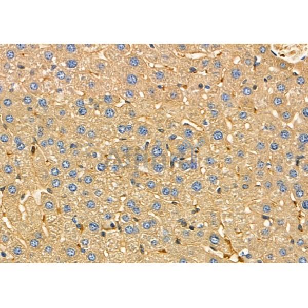 Cytochrome P450 20A1 Antibody - DF4760 at 1/100 staining Mouse liver tissue by IHC-P.