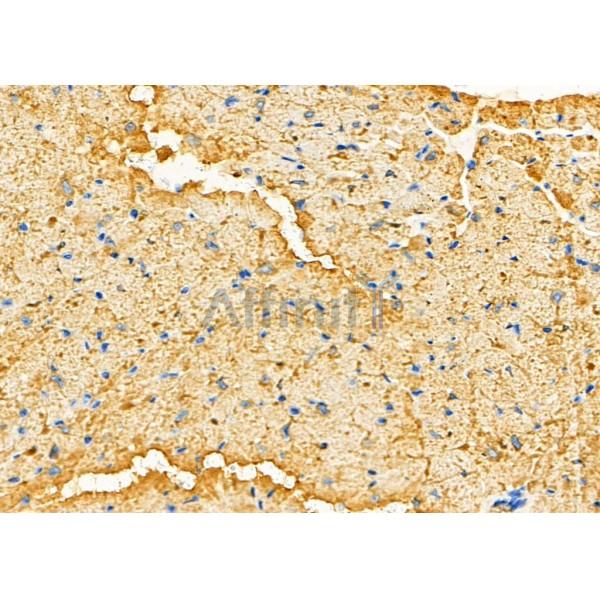CDC42BPA Antibody - DF4786 at 1/100 staining Mouse heart tissue by IHC-P.
