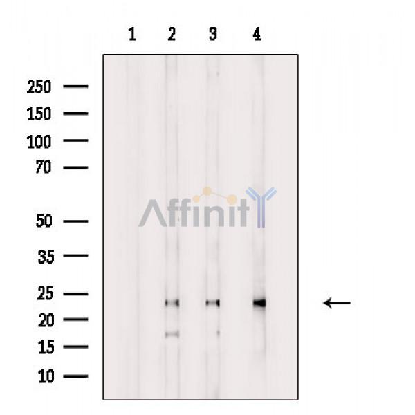 MXD3 Antibody - Western blot analysis of extracts from various samples, using MXD3 Antibody.