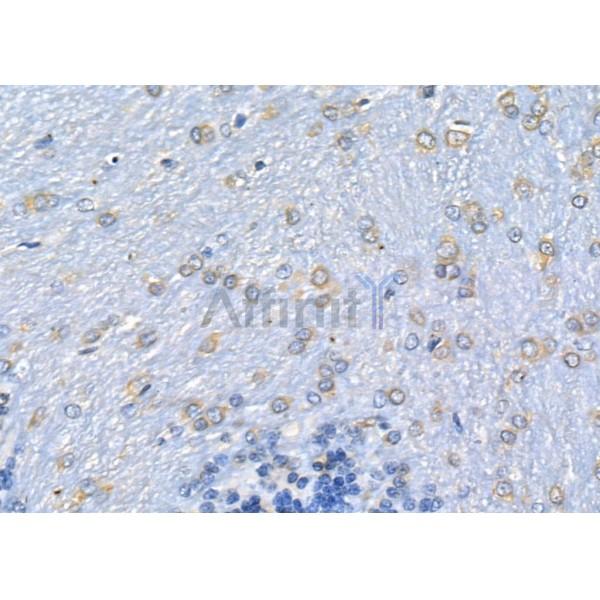 ICAM3 Antibody - DF7993 at 1/100 staining Rat brain tissue by IHC-P.