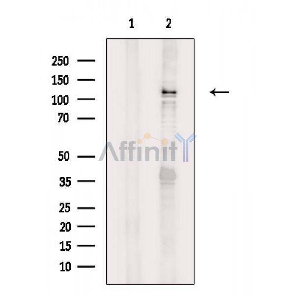 ICAM3 Antibody - Western blot analysis of extracts from HepG2 cells(serum starvation treatment), using ICAM3 Antibody.