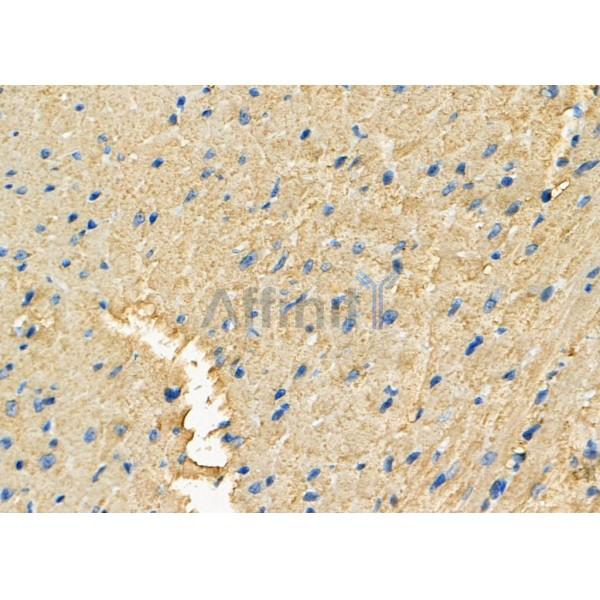 FAIM3 Antibody - DF8075 at 1/100 staining Mouse heart tissue by IHC-P.