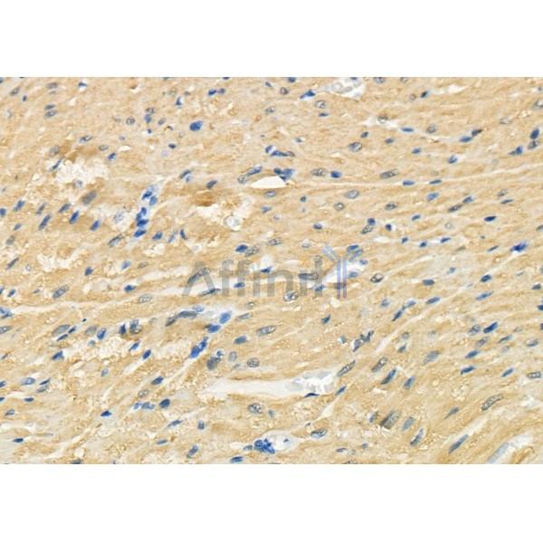 PTP4A2 Antibody - DF8076 at 1/100 staining Rat heart tissue by IHC-P.