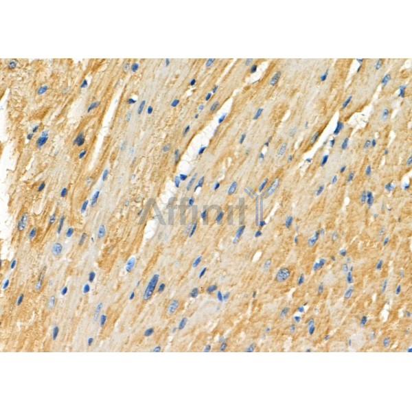 P4HTM Antibody - DF8110 at 1/100 staining Mouse heart tissue by IHC-P.