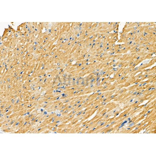 P4HTM Antibody - DF8110 at 1/100 staining Rat heart tissue by IHC-P.