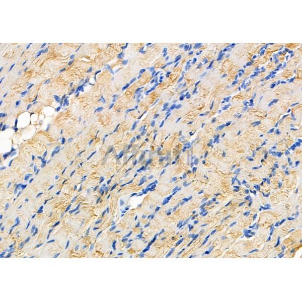 P4HTM Antibody - DF8110 at 1/100 staining Rat muscle tissue by IHC-P.