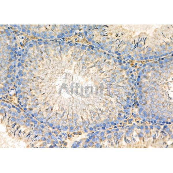DSP Antibody - DF8312 at 1/100 staining Rat testis tissue by IHC-P.