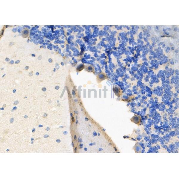 ZFYVE9 Antibody - DF8327 at 1/100 staining Rat brain tissue by IHC-P.