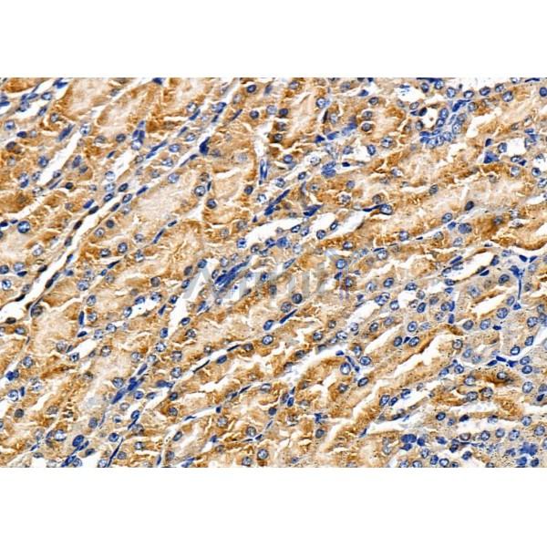 CAP2 Antibody - DF8357 at 1/100 staining Mouse kidney tissue by IHC-P.