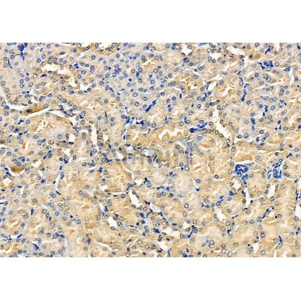 EBI3 Antibody - DF8363 at 1/100 staining Mouse kidney tissue by IHC-P.