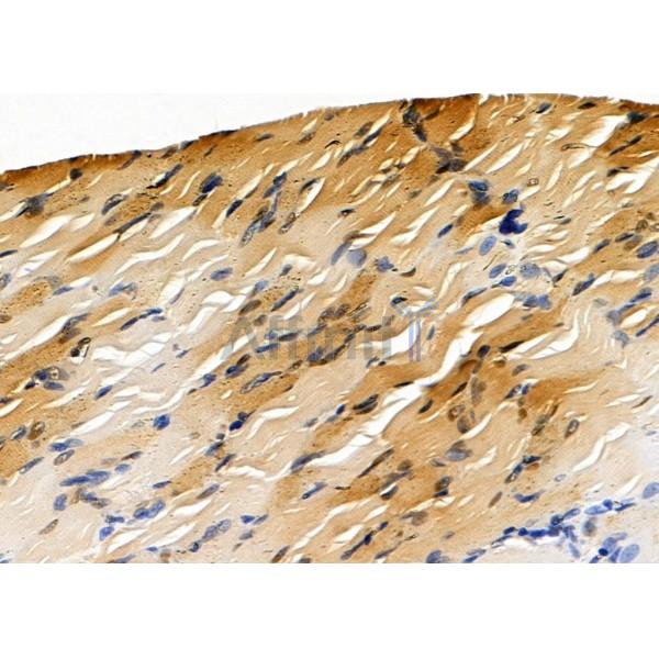 COPS7A Antibody - DF8375 at 1/100 staining Mouse ovarian tissue by IHC-P.
