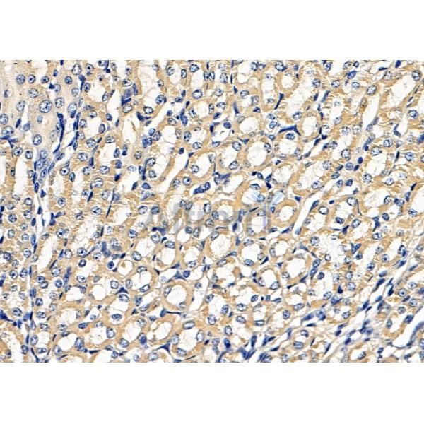 ARF5 Antibody - DF8451 at 1/100 staining Mouse kidney tissue by IHC-P.