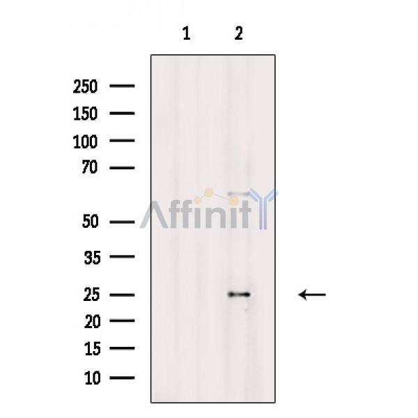 ASCL1 Antibody - Western blot analysis of extracts from Rat muscle, using ASCL1 Antibody.