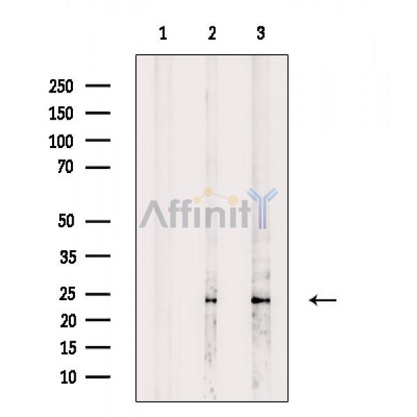 eEF1B2 Antibody - Western blot analysis of extracts from various samples, using eEF1B2 Antibody.
