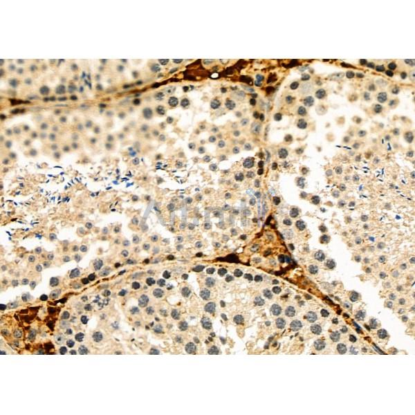 HIF-3 alpha Antibody - DF8557 at 1/100 staining Mouse lung tissue by IHC-P.