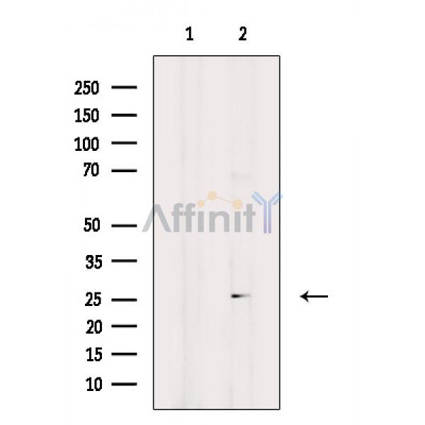 IL32 Antibody - Western blot analysis of extracts from Hela cells(H2O2 treatment), using IL32 Antibody.