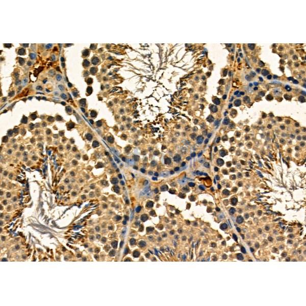 APOBEC3A/B Antibody - DF9776 at 1/100 staining Mouse lung tissue by IHC-P.