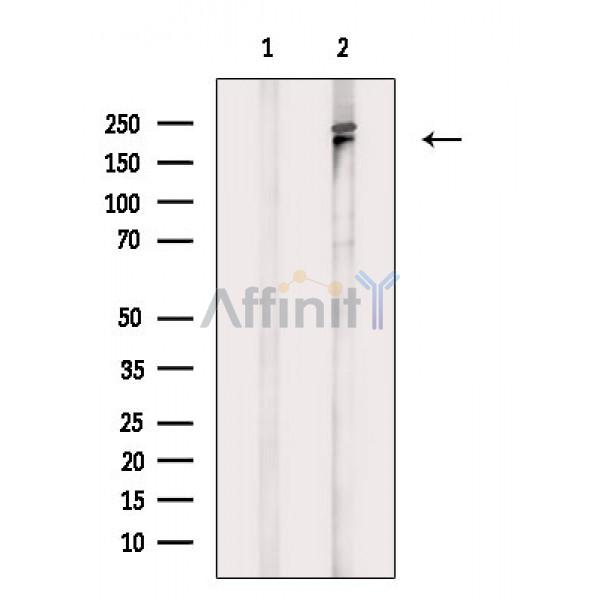 Phospho-53BP1 (Thr543) Antibody - Western blot analysis of extracts from PC12(LPS 4h treatment), using Phospho-53BP1 (Thr543) Antibody.