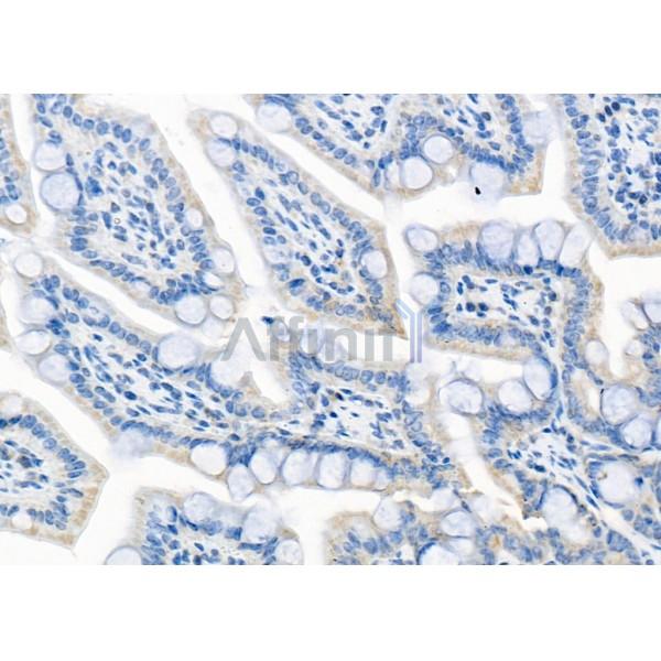 PERK Mouse monoclonal Antibody - BF8011 at 1/100 staining Rat kidney tissue by IHC-P.