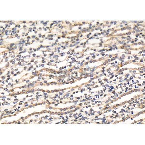 RBPMS Antibody - DF13276 at 1/100 staining Rat kidney tissue by IHC-P.