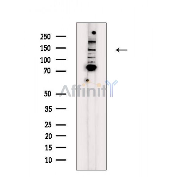 MYOCD Antibody - Western blot analysis of extracts from H2O2 treated Hela cells , using MYOCD Antibody.