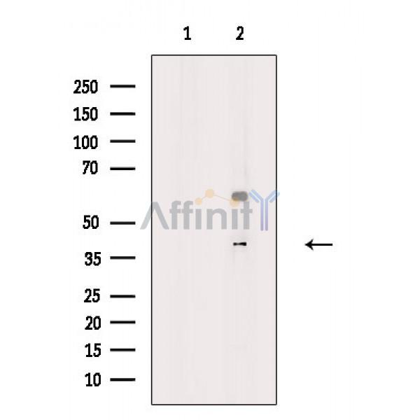 CXADR Antibody - Western blot analysis of extracts from Rat heart, using CXADR Antibody.