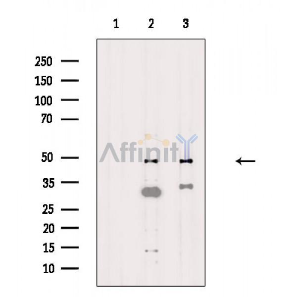 NUSAP1 Antibody - Western blot analysis of extracts from various samples, using NUSAP1 Antibody.