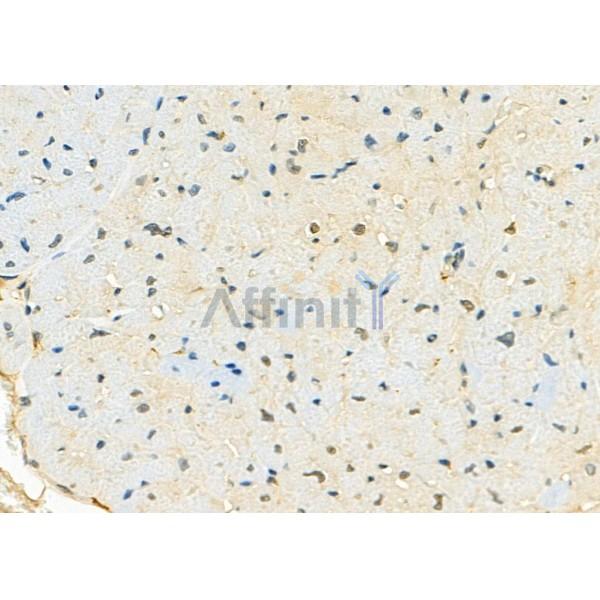 RBBP7 Antibody - DF8024 at 1/100 staining Mouse heart tissue by IHC-P.