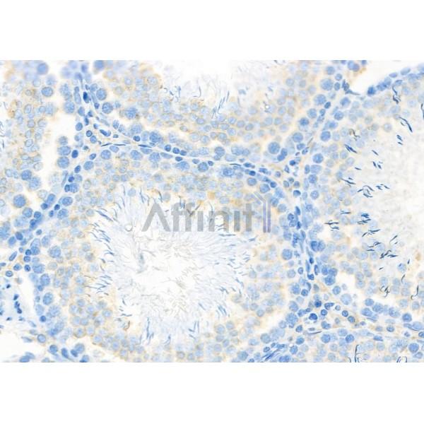 KATNA1 Antibody - DF8027 at 1/100 staining Rat testis tissue by IHC-P.