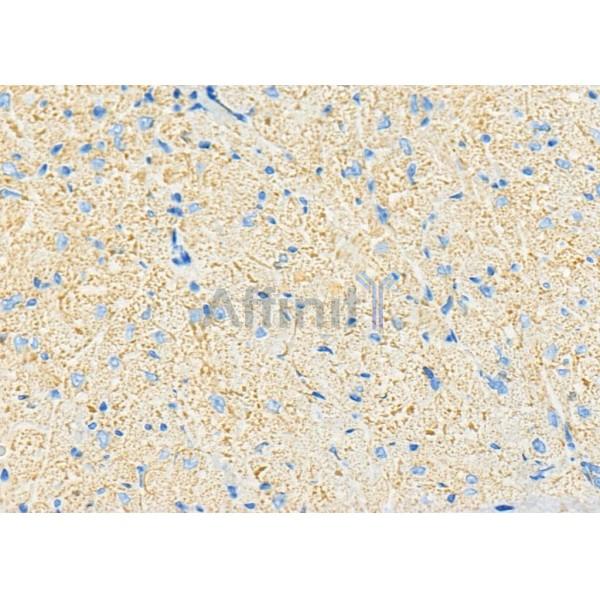 CYP3A5 Antibody - DF8032 at 1/100 staining Mouse heart tissue by IHC-P.