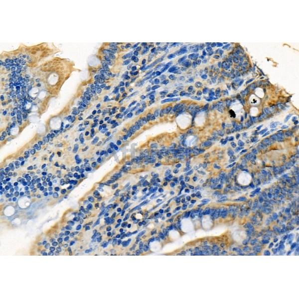 CYP3A5 Antibody - DF8032 at 1/100 staining Mouse colorectal tissue by IHC-P.