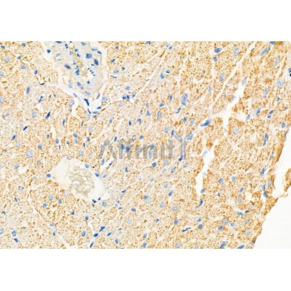 CYP3A5 Antibody - DF8032 at 1/100 staining Rat heart tissue by IHC-P.