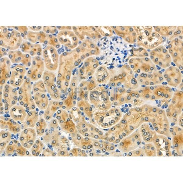 USP10 Antibody - DF8061 at 1/100 staining Mouse kidney tissue by IHC-P.