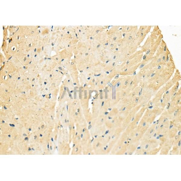 MBNL1 Antibody - DF8062 at 1/100 staining Rat heart tissue by IHC-P.