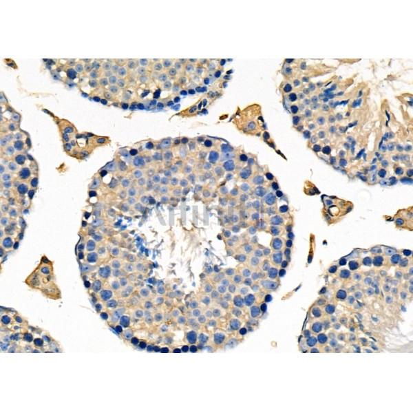 UGGT1 Antibody - DF8205 at 1/100 staining Mouse testis tissue by IHC-P.