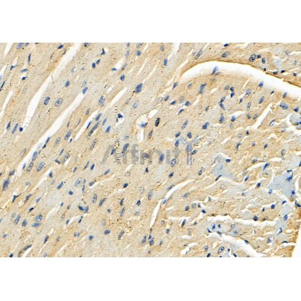 SEPP1 Antibody - DF8258 at 1/100 staining Mouse heart tissue by IHC-P.