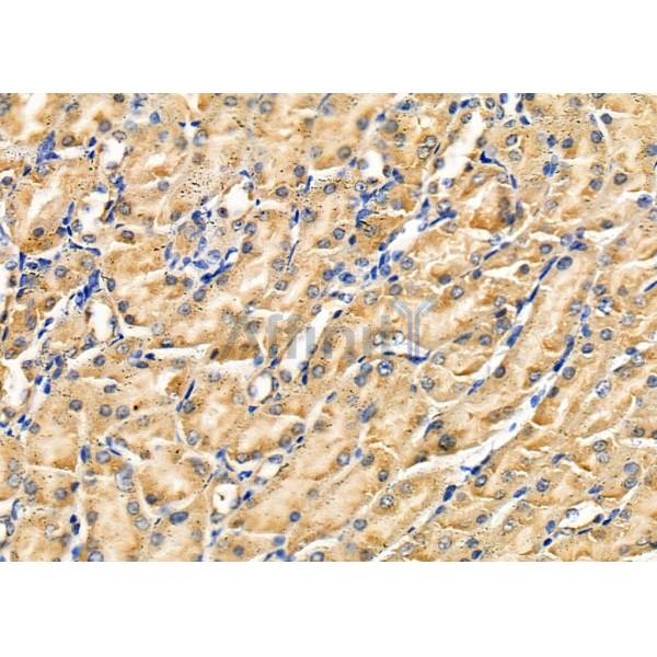 Galectin 8 Antibody - DF8262 at 1/100 staining Rat liver tissue by IHC-P.