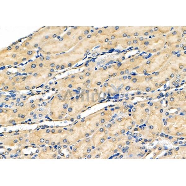 ALDH3A1 Antibody - DF8502 at 1/100 staining Mouse kidney tissue by IHC-P.