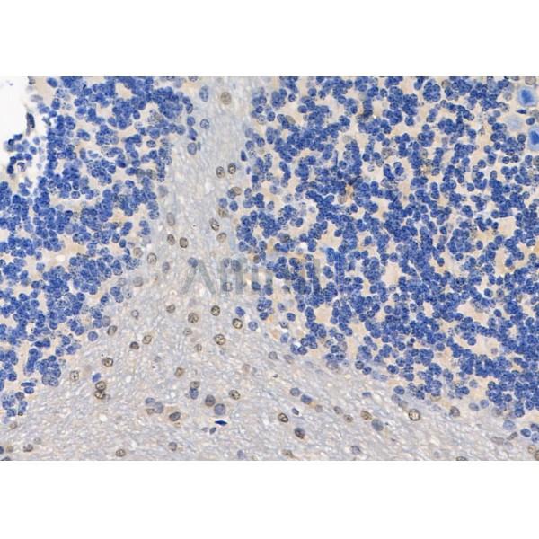 HIC-2 Antibody - DF8556 at 1/100 staining Rat brain tissue by IHC-P.