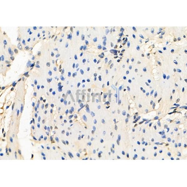 HIC-2 Antibody - DF8556 at 1/100 staining Rat stomach tissue by IHC-P.